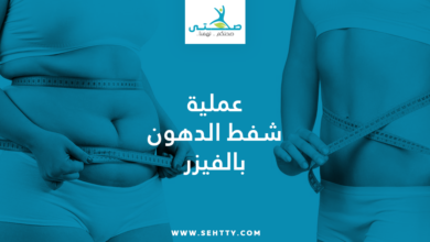 عملية شفط الدهون بالفيزر