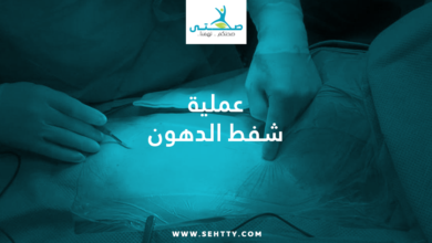 عملية شفط الدهون