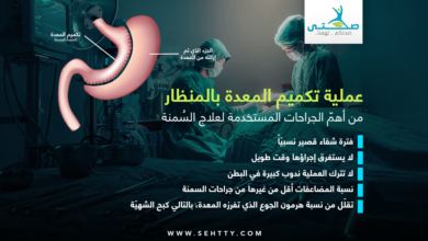 عملية تكميم المعدة بالمنظار