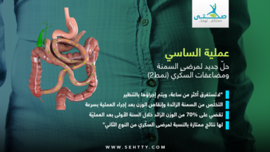 عملية الساسي