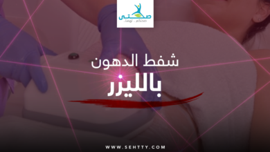 شفط الدهون بالليزر