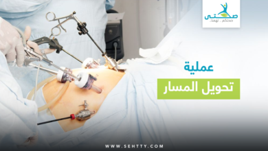 عملية تحويل المسار للمعدة