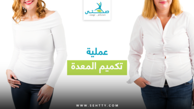 عملية تكميم المعدة