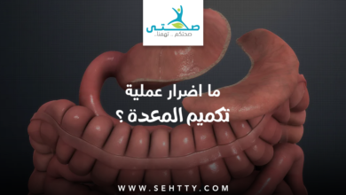 اضرار عملية تكميم المعدة