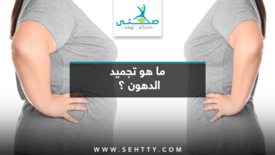 تجميد الدهون