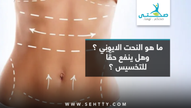 النحت الايوني